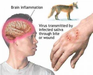 brain-swelling-due-to-Rabies-Virus